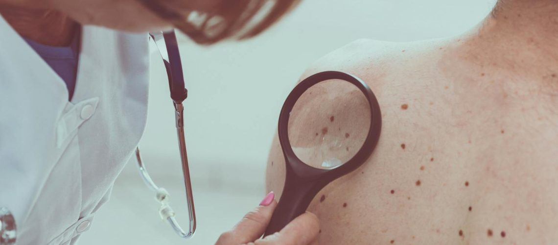 Cancer de la peau : quels sont les symptômes ? Cancer de la peau : quels sont les symptômes ?